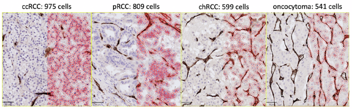 Fig. 1: Histological analysis of cell size using H&E-staining.