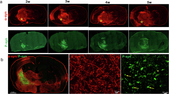 Fig. 1: Human α-syn and p-syn expression in mouse brains from 2 to 5 weeks post-injection.