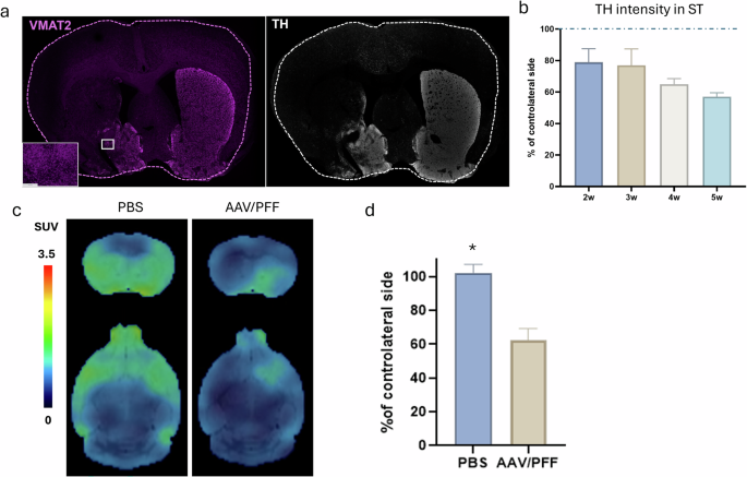 Fig. 2: DA neuron degradation in the striatum.
