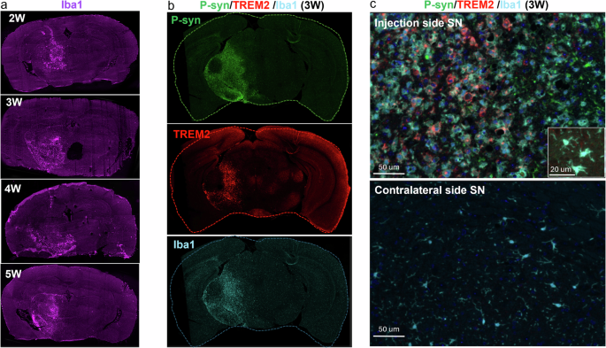 Fig. 3: Neuroinflammation was colocalized with aggregated α-syn deposits.