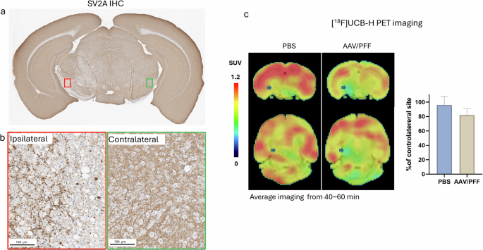 Fig. 5: SV2A density reduction.