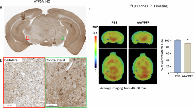 Fig. 6: Mitochondrial dysfunction.
