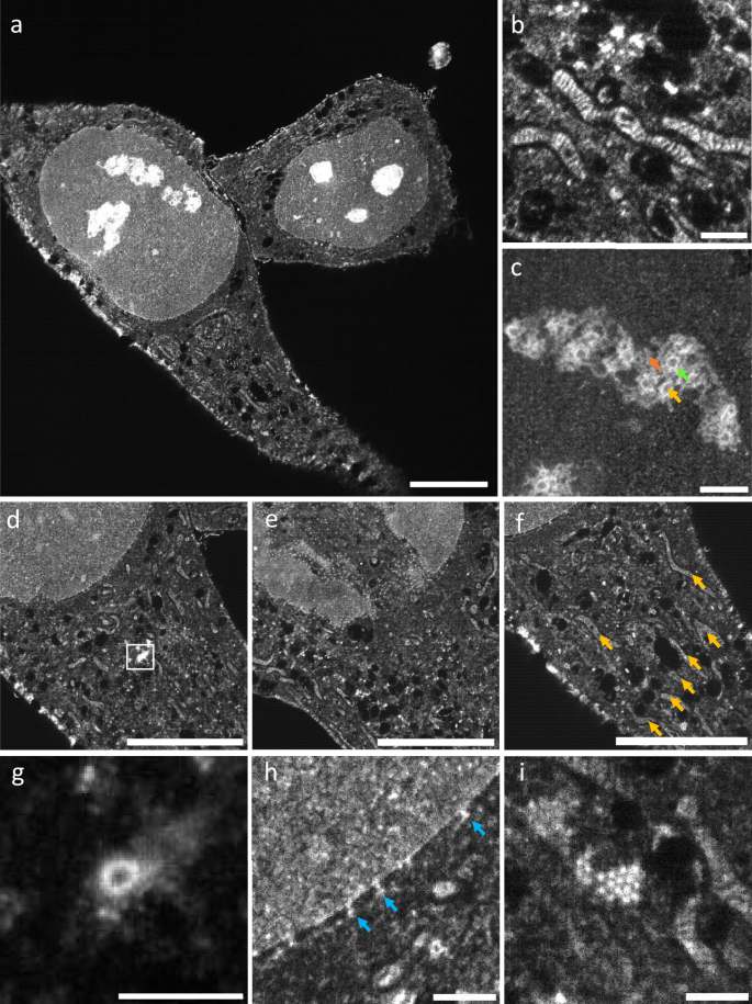 Fig. 2: pan-ASLM images of pan-expanded HeLa cells.