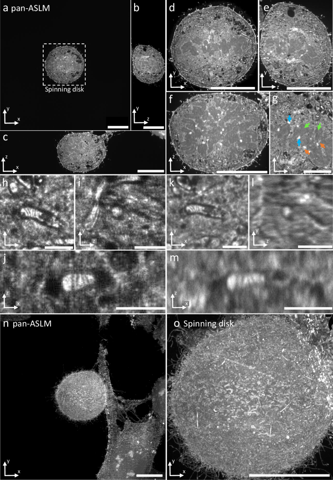 Fig. 3: Comparison between pan-ASLM and spinning disk microscopy images.