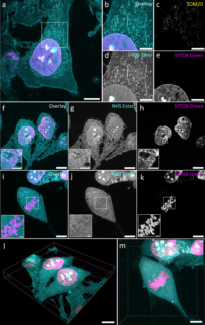 Fig. 4: High-speed and multicolor imaging of pan-expanded HeLa cells.