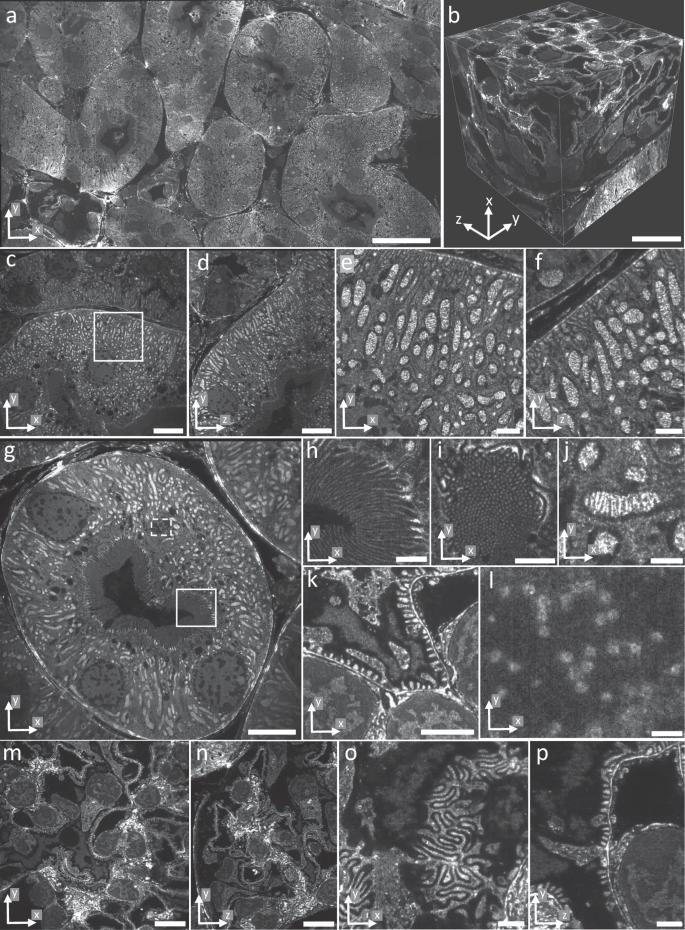 Fig. 5: Large-FOV imaging of pan-expanded mouse kidney tissue.