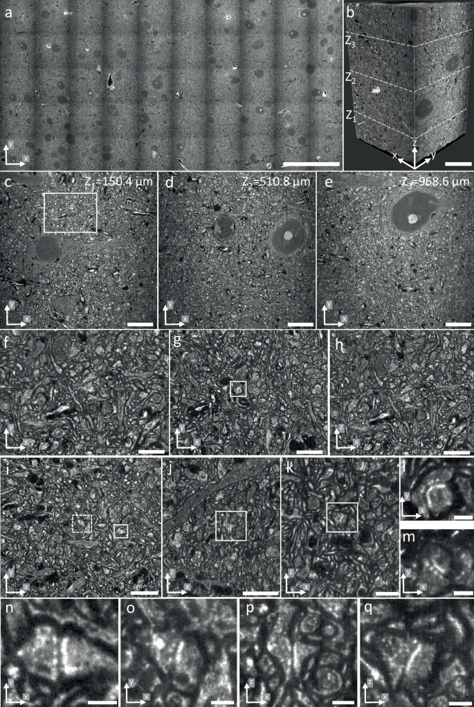 Fig. 6: Large-volume imaging of pan-expanded mouse cortex.