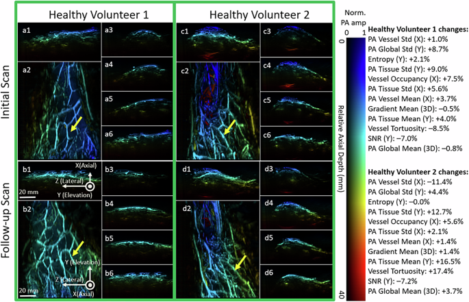 Fig. 4: Longitudinal vascular imaging in healthy volunteers.