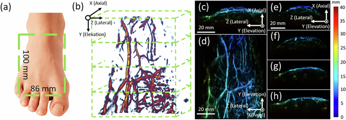 Fig. 8: PA imaging and 3D vascular reconstruction.