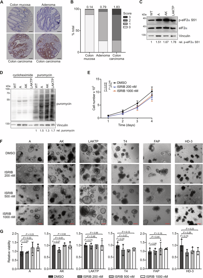 deplete glutathione blood cells Glutathione Depletion and Stalwart Anticancer Activity of  Metallotherapeutics Inducing Programmed Cell Death: Opening a New Window  for Cancer Therapy