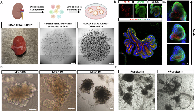 Human fetal kidney organoids model early human nephrogenesis and  Notch-driven cell fate | The EMBO Journal | Springer Nature Link