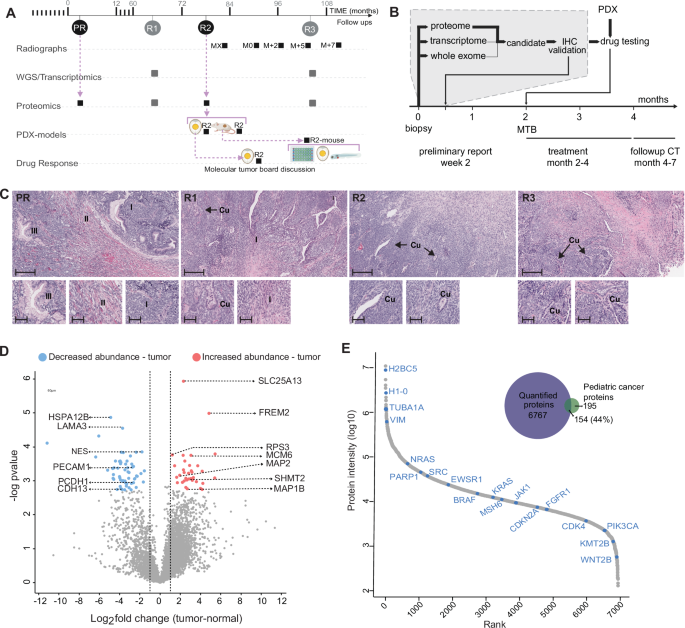 小児がんに適した薬剤を見つける新たなプロテオミクス手法を開発(Researchers develop new way to match young cancer patients with the right drugs)