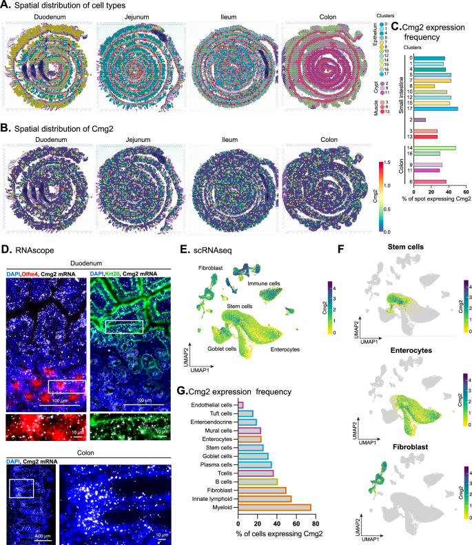希少疾患遺伝子が腸の損傷後再生を制御(Gene of rare disease controls post-injury gut regeneration)