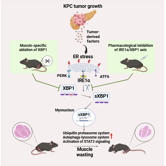 膵がんによる筋萎縮を抑える新たな標的を発見(University of Houston Researchers Identify New Target to Counteract Muscle Wasting in Pancreatic Cancer)