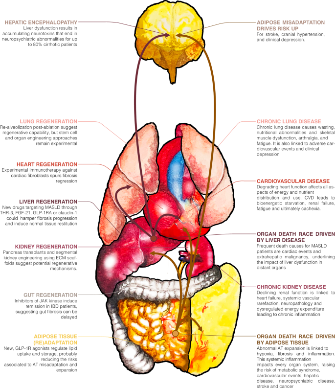 Fig. 3: Local ECM-associated disease drives systemic dysfunction, but new therapies can revert the course.