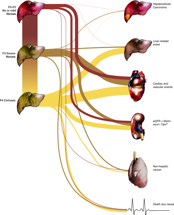Fig. 4: Outcomes in adults with MASLD.