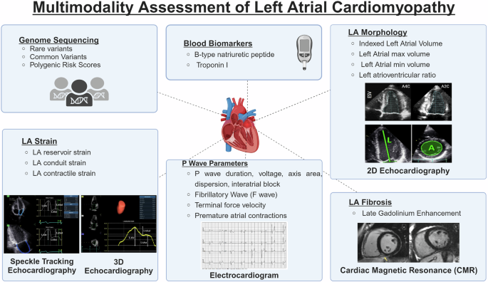 Fig. 2: Multimodality assessment of left atrial cardiomyopathy.