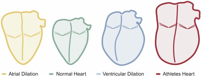 Fig. 3: Proposed structural overlap in four categories of patients.