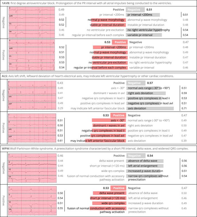 Fig. 1: Qualitative analysis of ZETA’s interpretable predictions.