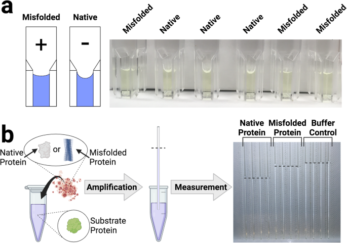 神経変性疾患の早期発見を可能にする新しい視覚技術(New visual technique could advance early detection of neurodegenerative diseases)