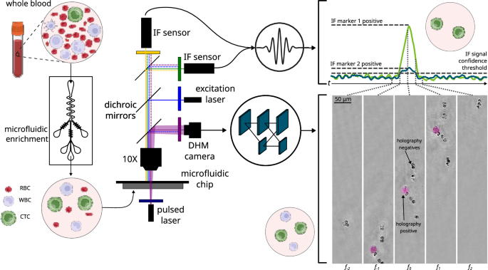 Fig. 1: System overview, depicting the detection of CTC candidates based on a combination of microfluidic inertial enrichment, digital holographic microscopy signature, and immunofluorescence (IF) expression.