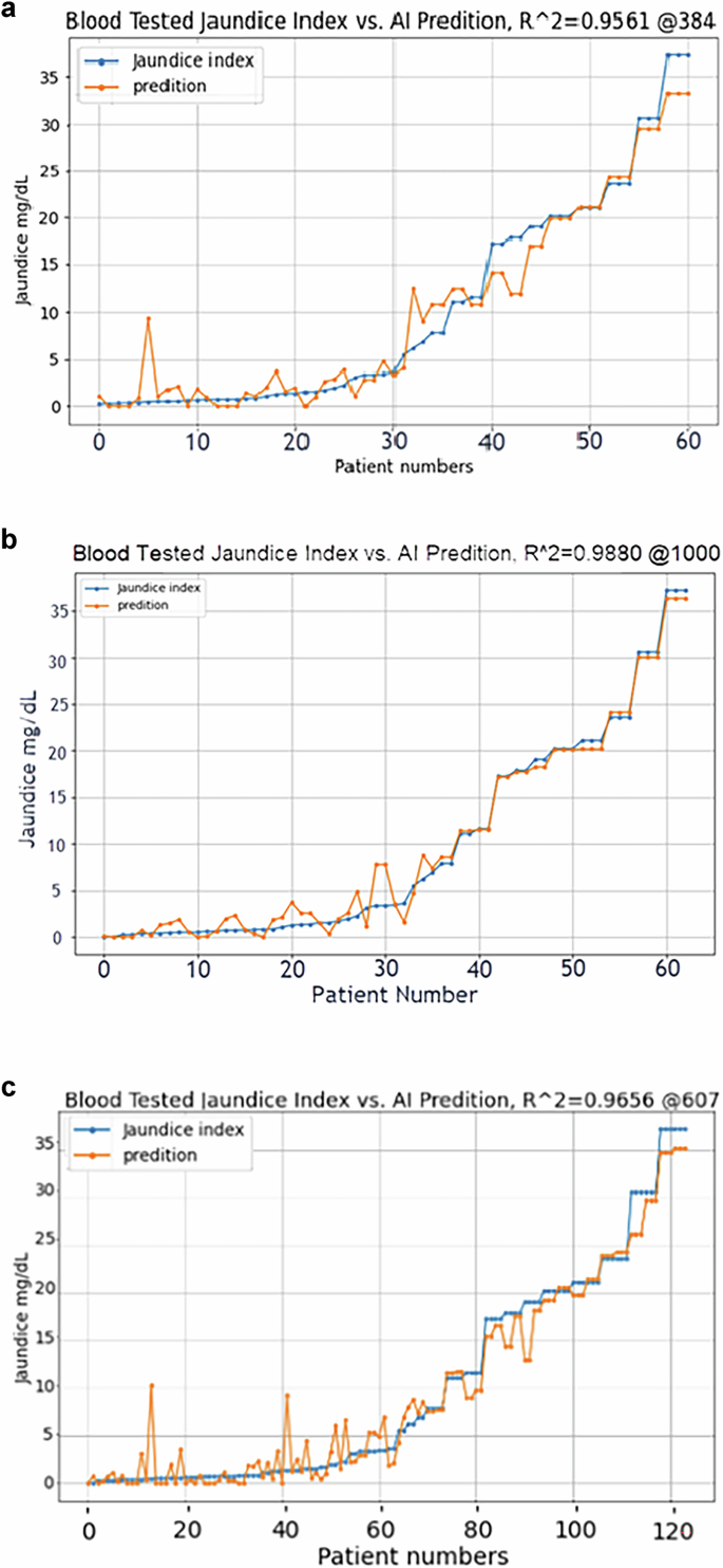Fig. 12: Prediction performance of JaundiceAI-Mobile under different lighting conditions.