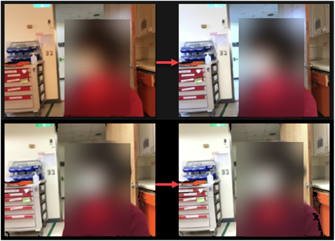 Fig. 1: Image normalization under different lighting conditions for Mobile Jaundice AI.