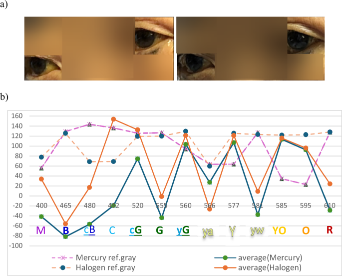 Fig. 5: Multispectral wavelength polylines from scleral ROIs of a severely jaundiced patient.