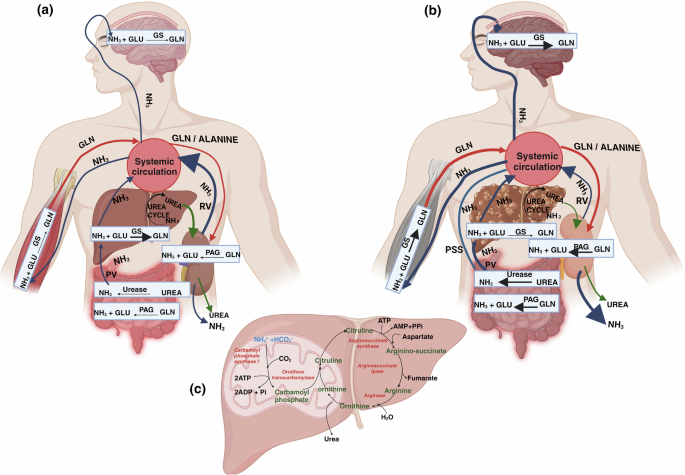 Gut microbiota and dynamics of ammonia metabolism in liver disease