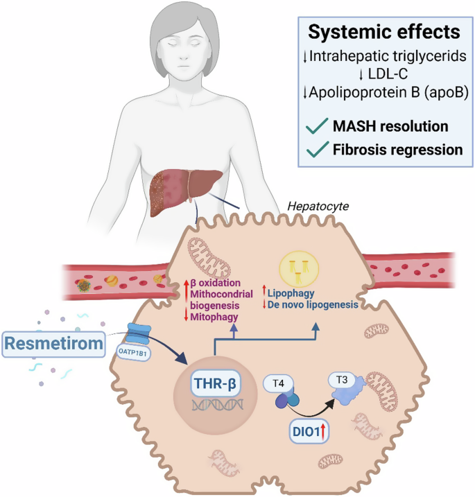 Reviewing MAESTRO-NASH and the implications for hepatology and health systems in implementation/accessibility of Resmetirom