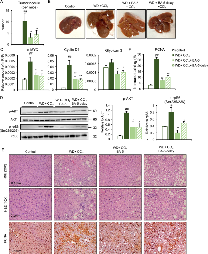 Fig. 7: Effects of BA-5 treatment on WD + CCl4-induced liver tumor formation in mice.