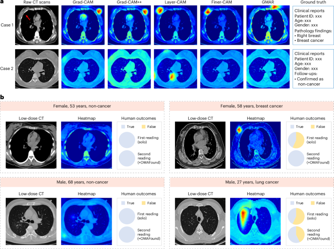 Fig. 5: The interpretability of OMAFound.