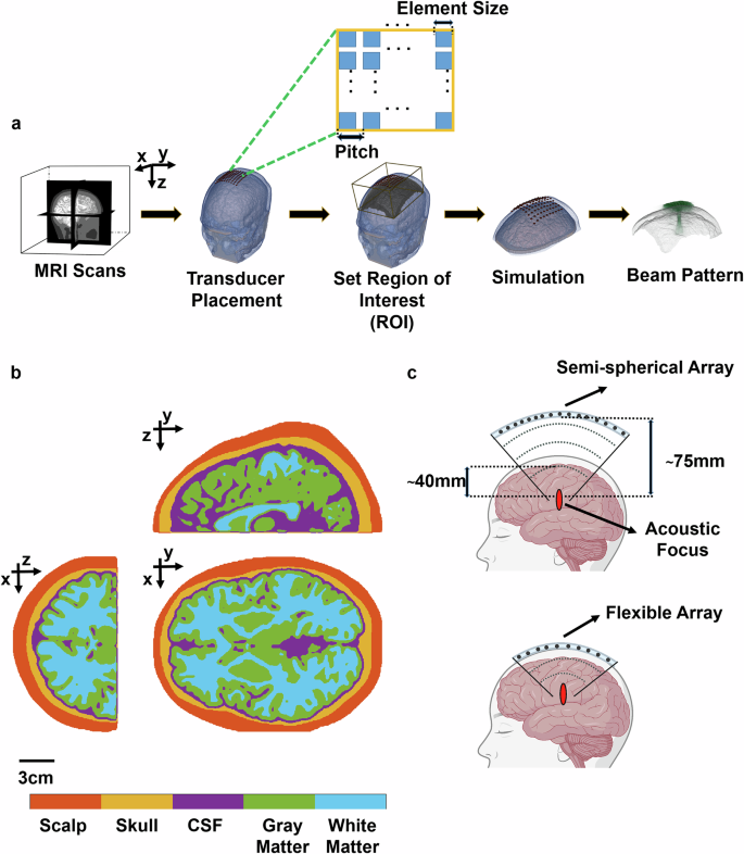 Fig. 1: Simulation of tFUS with a flexible array.
