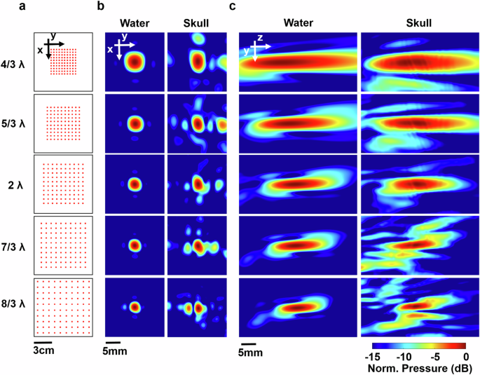 Fig. 2: Comparison of pressure profiles simulated with different pitch sizes for the uniform flexible arrays in water and through the skull.