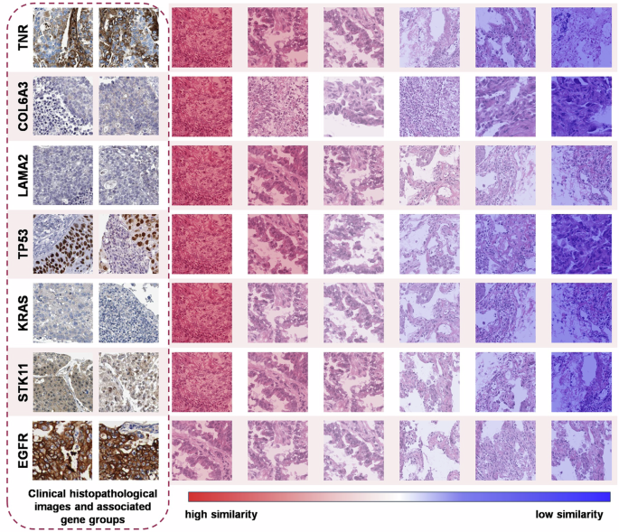 Fig. 5: Histopathological image similarity.
