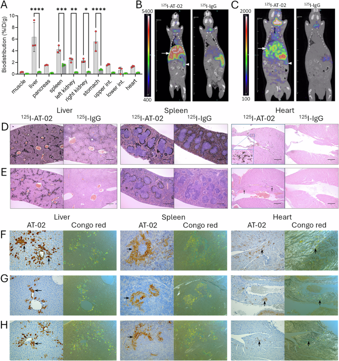 Fig. 7: Radiolabeled AT-02 binds tissue amyloid deposits in vivo.