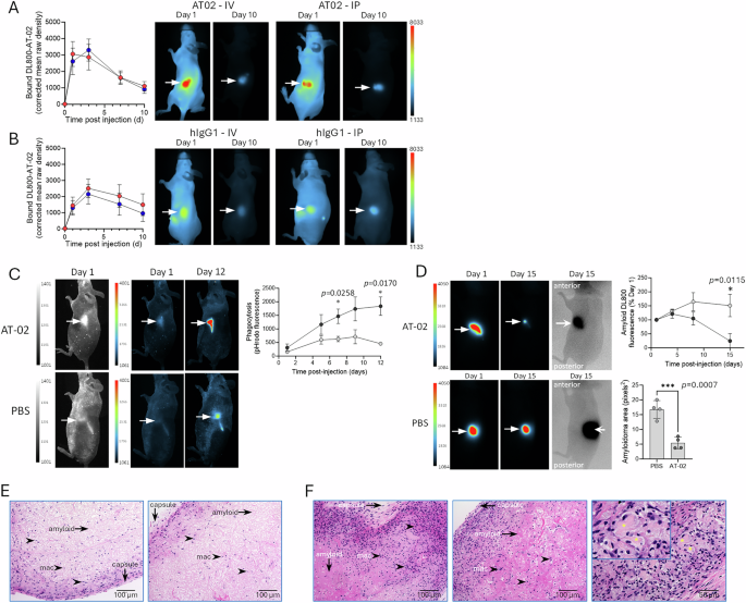 Fig. 8: AT-02 rapidly binds subcutaneous human ALλ amyloid in mice and can enhance phagocytosis and clearance.
