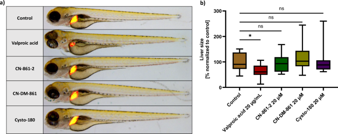 Fig. 4: In vivo toxicity evaluation of CYS in zebrafish embryos revealed no abnormalities in liver morphology.
