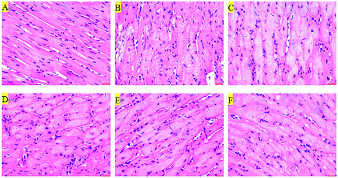 Fig. 4: Histological Assessment of JK07-Mediated Myocardial Remodeling.