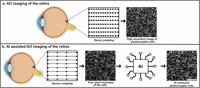 Fig. 1: Artificial intelligence (AI) assisted imaging uses sparse sampling to recover cone visualization in the human retina.