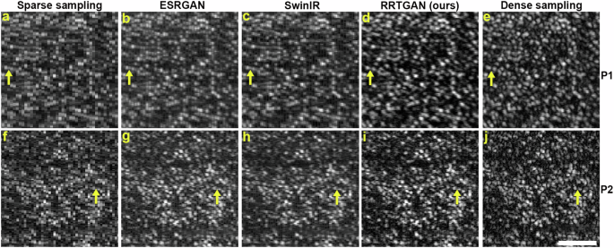 Fig. 2: Residual in residual transformer generative adversarial network (RRTGAN) restores the pixel resolution of sparsely sampled images to match dense sampling.