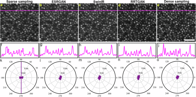 Fig. 3: Artificial intelligence (AI) restores shape of the cones from sparsely sampled images.