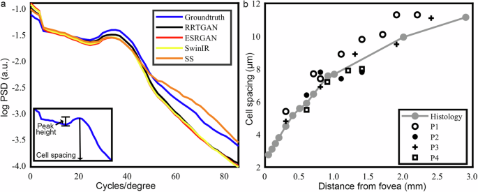 Fig. 4: Cone cell spacing of the artificial intelligence (AI) enhanced images are comparable to the ground truth densely sampled images.