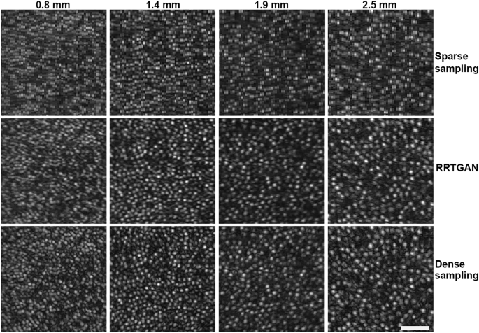 Fig. 5: Residual in residual transformer generative adversarial network (RRTGAN) and the ground truth densely sampled images have similar appearance of the cones for experimental data at different retinal locations.