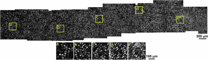 Fig. 6: Residual in residual transformer generative adversarial network (RRTGAN) enables efficient large-scale visualization of cone photoreceptors across the retina.