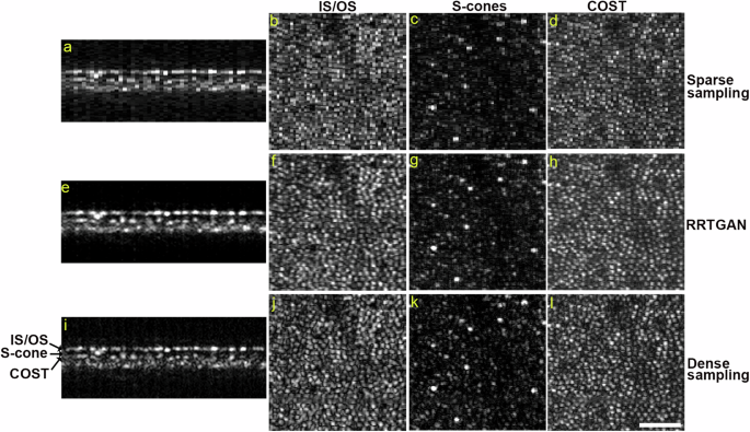Fig. 7: Residual in residual transformer generative adversarial network (RRTGAN) restores the 3D structure of cones.