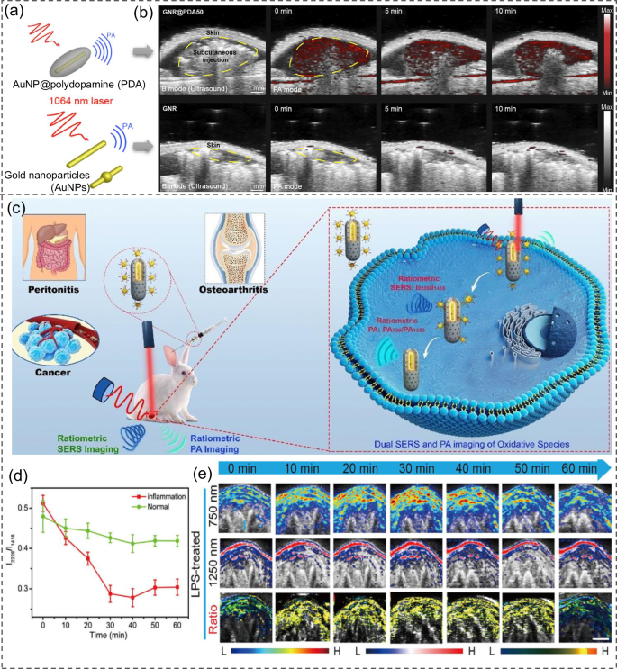 Fig. 18: Plasmon-enhanced photoacoustic bioimaging.
