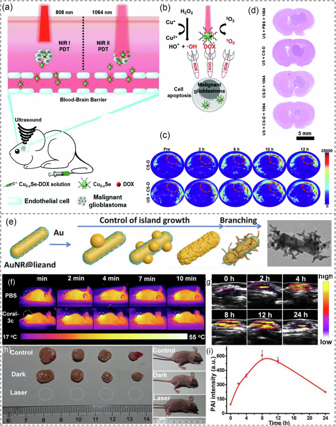 Fig. 19: Photoacoustic imaging-guided plasmonic therapy.