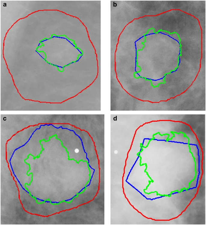 Fig.2