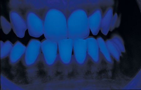 Digital Dental Photography Part 5 Lighting British Dental Journal